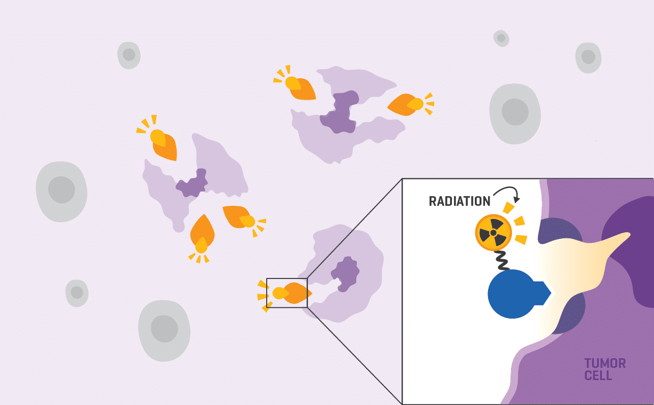 Radiation affecting tumor cell