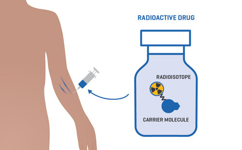 Illustration of injection of radioisotope