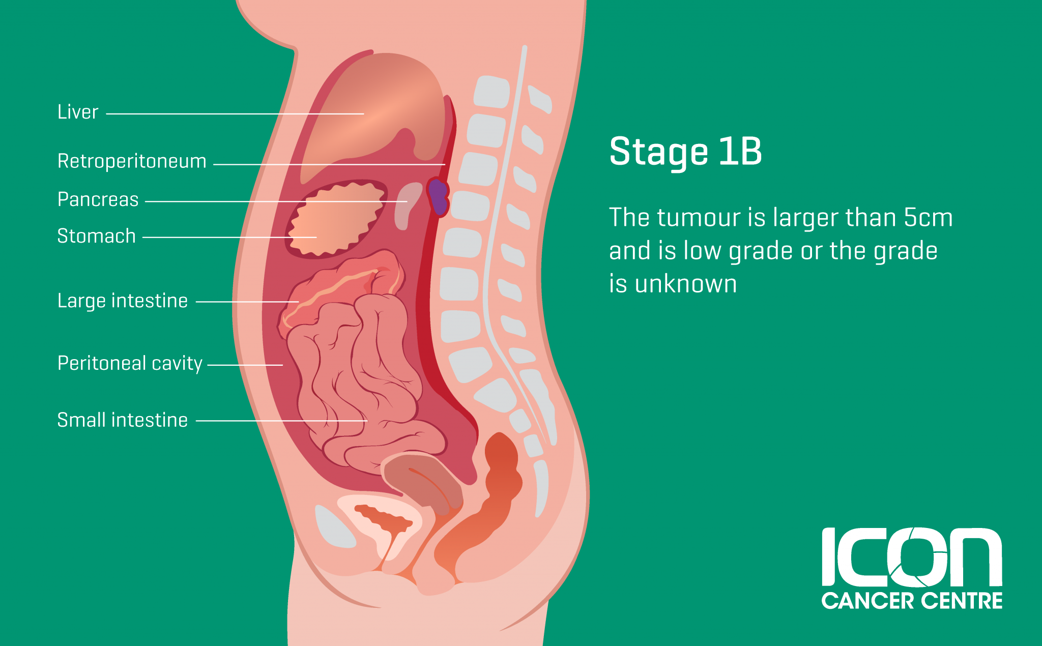 what-is-soft-tissue-sarcoma-soft-tissue-sarcoma-explained-icon