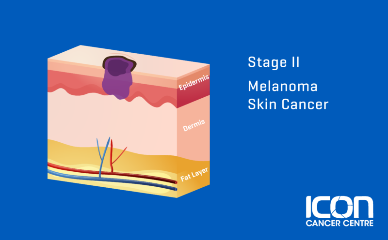 What Is Melanoma Melanoma Explained Icon Cancer Centre 7772